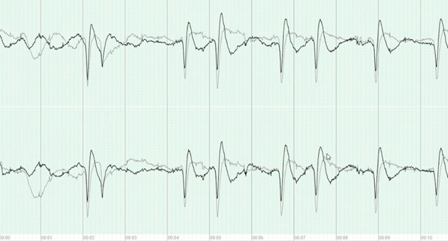eeg filters worksheet